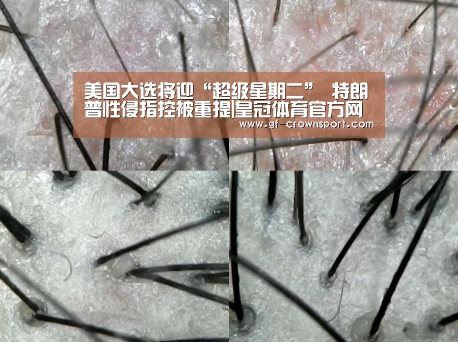 皇冠体育网址
